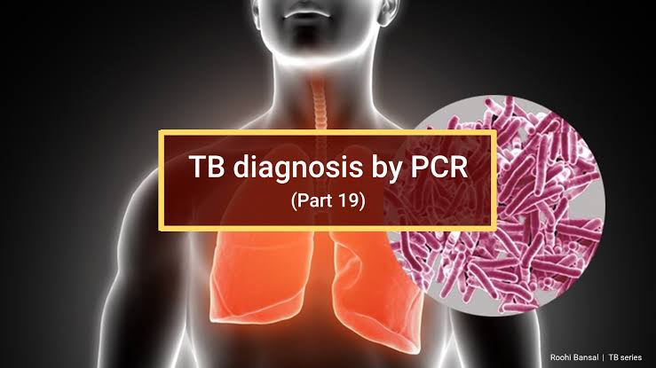 PCR for tb