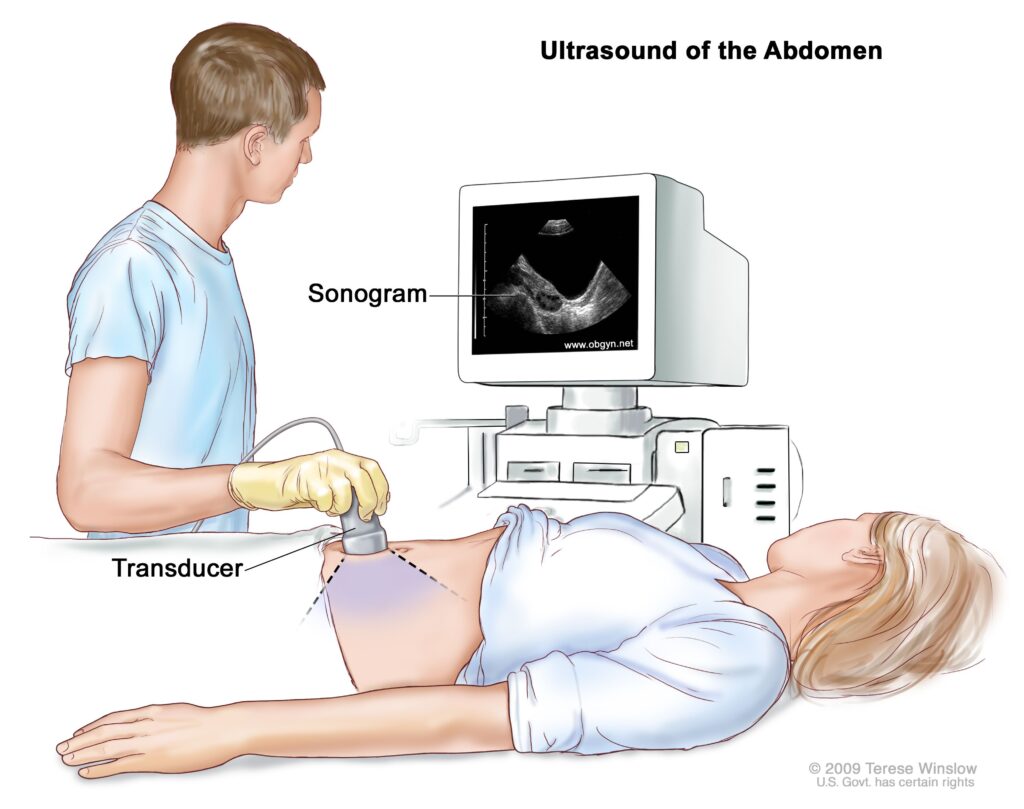 Abdominal Pelvic Ultrasound