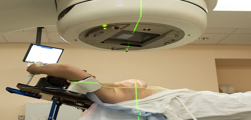 radiotherapy for breast cancer