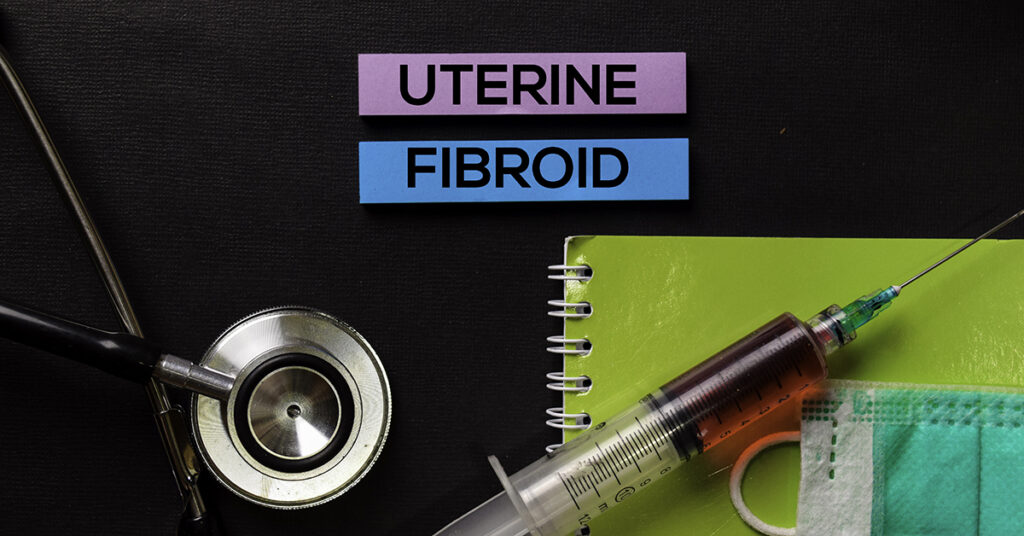 uterine fibroids