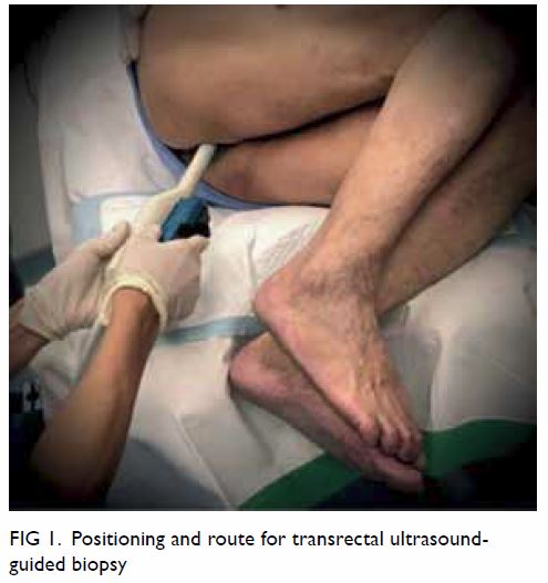 Transrectal Ultrasound (TRUS)