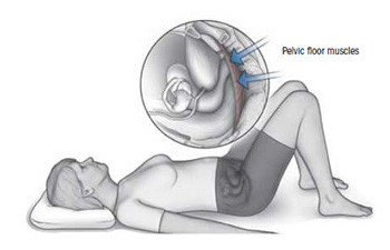 Kegel exercises