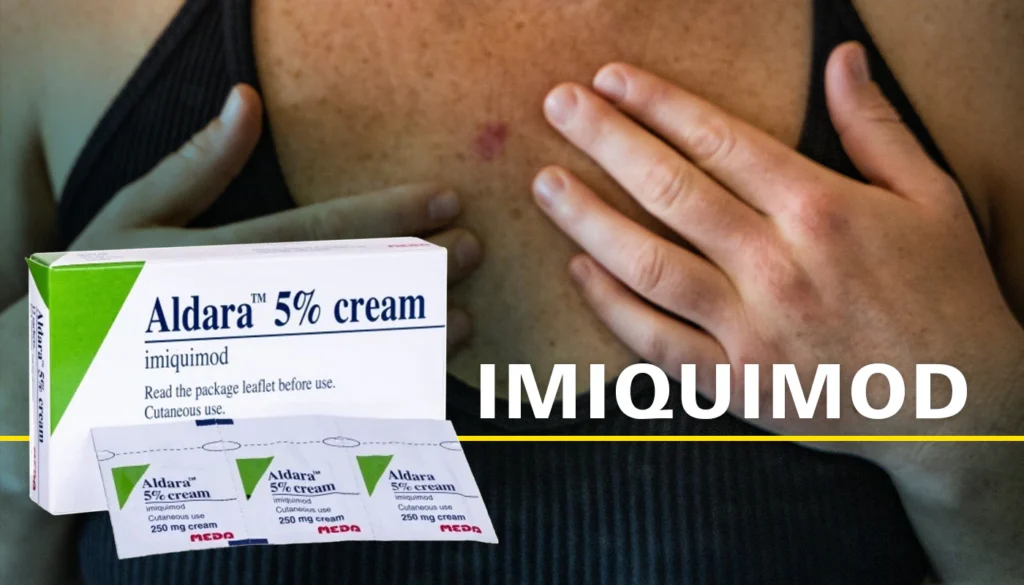 Imiquimod (Aldara cream)